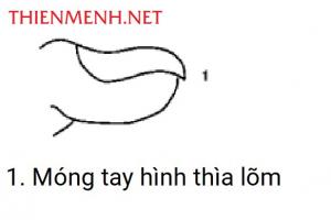 Nhìn Màu sắc hình dạng của Móng Tay biết ngay bệnh gì