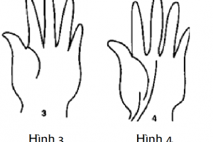 Xem Bói Chỉ Tay: Phát Hiện Bệnh Tật Qua Đường Chỉ Tay